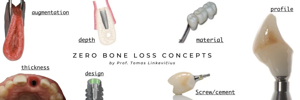 Sıfır sümük itkisi konsepsiyası — implant ətrafında krestal sümüyün qorunması