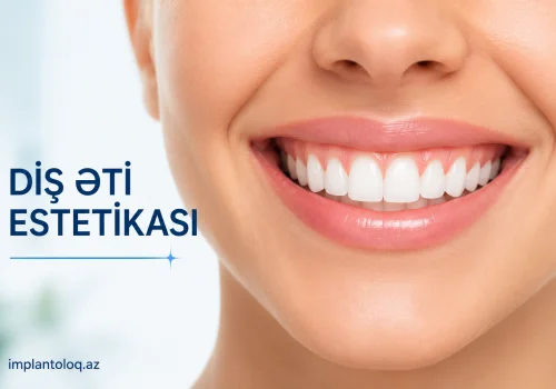 Dis Eti Estetikasi: &amp;quot;Gummy Smile&amp;quot; (Gulus Zamani Dis Etinin Gorunmesi) Problemi