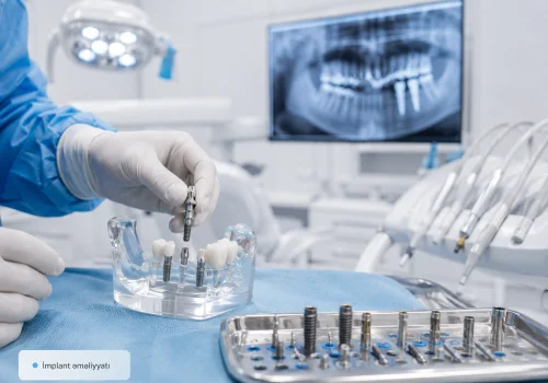 Implant emeliyyati