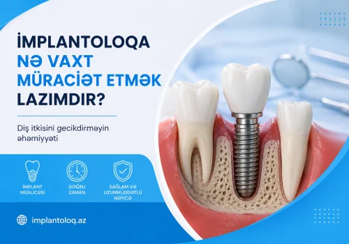 Implantoloqa Ne Vaxt Muraciet Etmek Lazimdir? Dis Itkisini Gecikdirmeyin Ehemiyyeti
